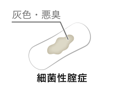 灰色・悪臭 細菌性腟症